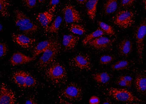 Anti-Human ANGPT2 Antibody [B268] - ABMIUM