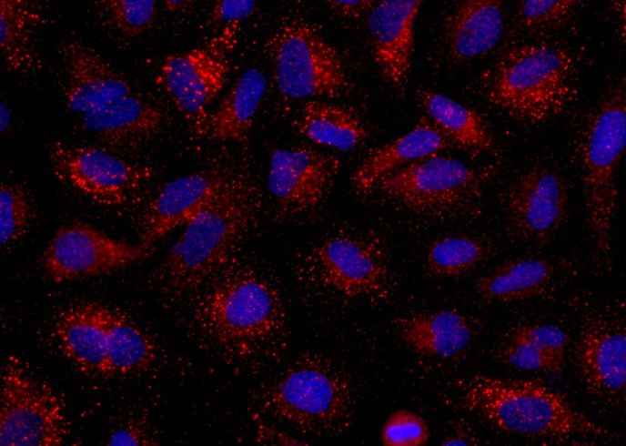 Anti-Human ANGPT2 Antibody [B268]