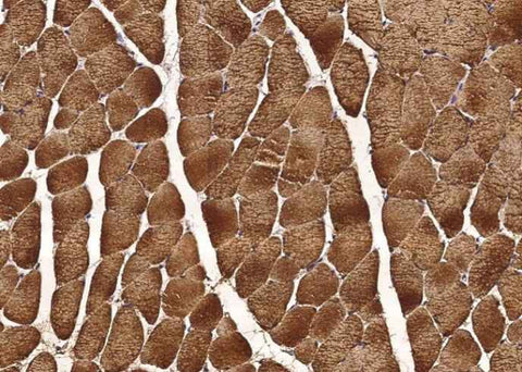 Anti-Human CA3 Antibody [B110] - ABMIUM