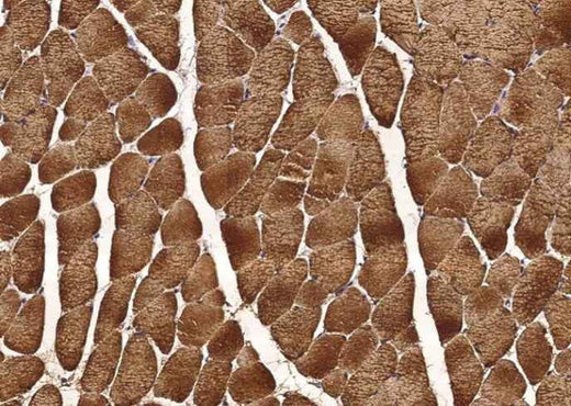 Anti-Human CA3 Antibody [B110] - ABMIUM