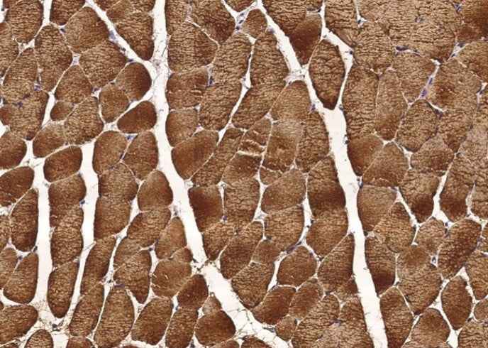 Anti-Human CA3 Antibody [B110]