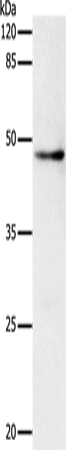 Anti-Human DRD1 Antibody - ABMIUM