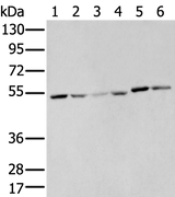 Anti-Human MMP1 Antibody - ABMIUM