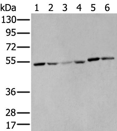 Anti-Human MMP1 Antibody - ABMIUM