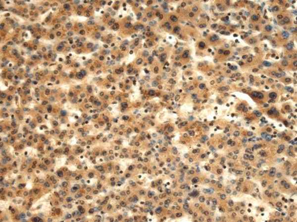 Anti-Human/Mouse/Rat TMOD1 Antibody