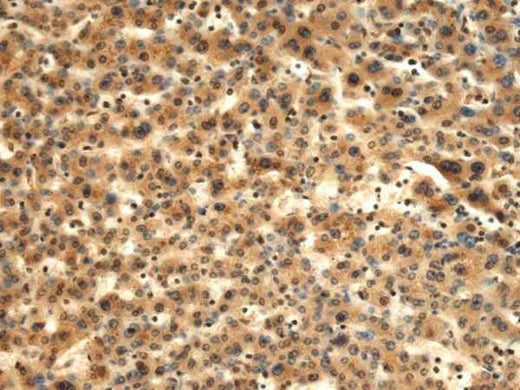 Anti-Human/Mouse/Rat TMOD1 Antibody