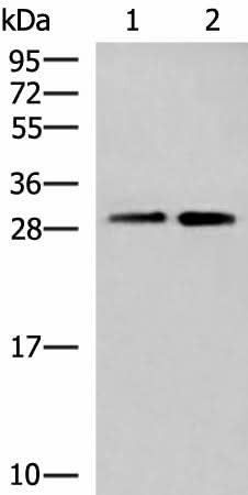 Western blot analysis of A549 cell and Human cerebrum tissue lysates using TBCB Polyclonal Antibody at dilution of 1:500