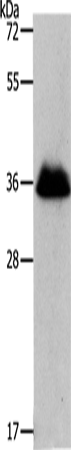 Anti-Human/Mouse/Rat RNF126 Antibody - ABMIUM