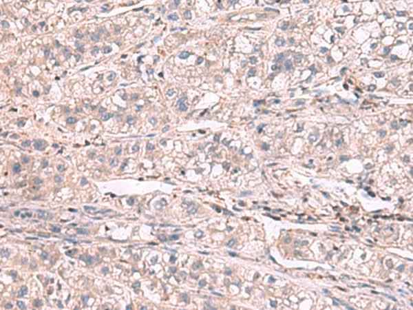 Anti-Human/Mouse/Rat KCNIP1 Antibody