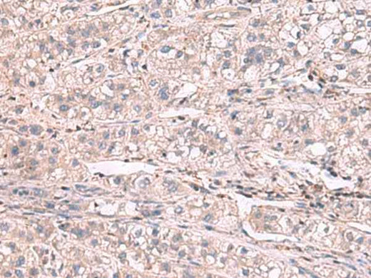 Anti-Human/Mouse/Rat KCNIP1 Antibody