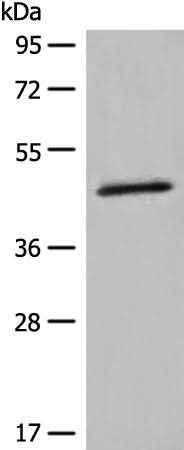 Western blot analysis of K562 cell lysate using HMBS Polyclonal Antibody at dilution of 1:450