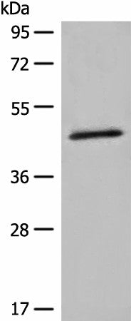 Western blot analysis of K562 cell lysate using HMBS Polyclonal Antibody at dilution of 1:450