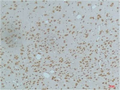 Immunohistochemistry of paraffin-embedded Rat brain tissue using Phospho-CAMK2 beta/gamma/delta (Thr287) Monoclonal Antibody at dilution of 1:200.