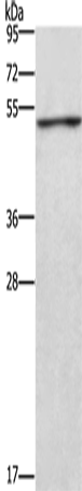 Anti-Human/Mouse/Rat CKMT2 Antibody - ABMIUM