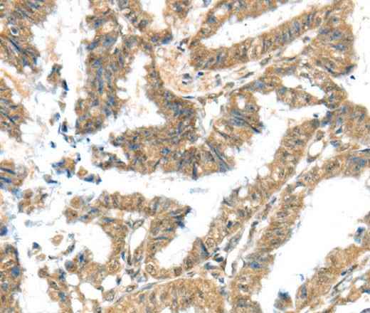 Anti-Human/Mouse/Rat KCNG3 Antibody