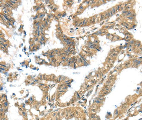 Anti-Human/Mouse/Rat KCNG3 Antibody - ABMIUM
