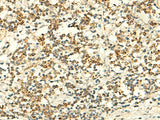 Immunohistochemistry of paraffin-embedded Human tonsil tissue using IFT27 Polyclonal Antibody at dilution of 1:50(×200)
