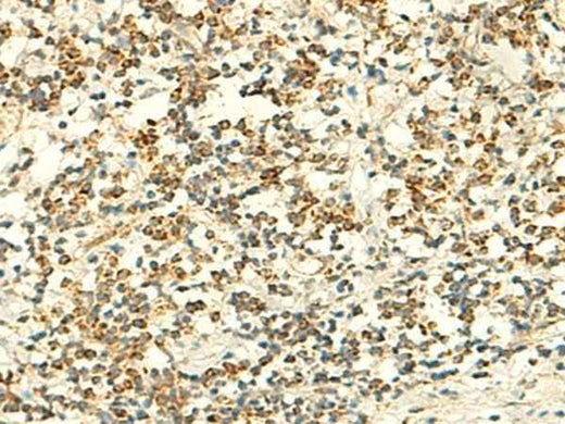 Anti-Human/Mouse IFT27 Antibody