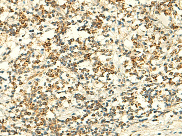 Immunohistochemistry of paraffin-embedded Human tonsil tissue using IFT27 Polyclonal Antibody at dilution of 1:50(×200)