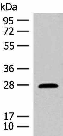 Anti-Human/Mouse GUCA1B Antibody