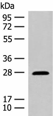 Western blot analysis of Mouse eye tissue lysate using GUCA1B Polyclonal Antibody at dilution of 1:500