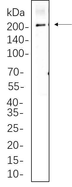 Anti-Human/Mouse LRP6 Antibody [B658] - ABMIUM