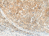 Anti-Human/Mouse KCNA10 Antibody - ABMIUM