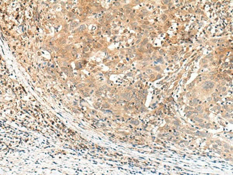 Anti-Human/Mouse KCNA10 Antibody - ABMIUM