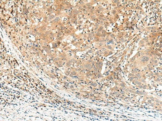 Anti-Human/Mouse KCNA10 Antibody - ABMIUM
