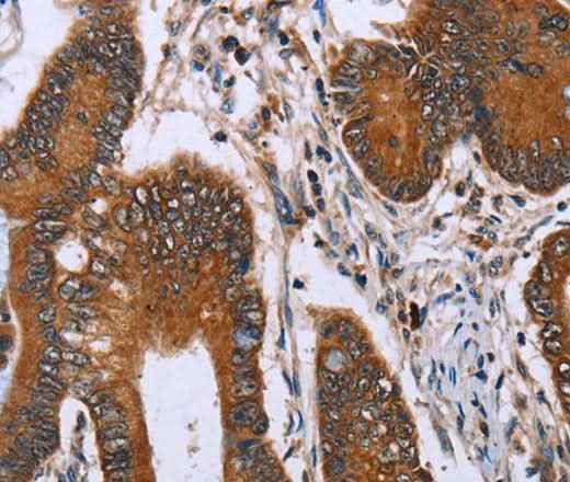 Anti-Human/Mouse IHH Antibody