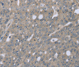 Anti-Human/Mouse BMX Antibody - ABMIUM