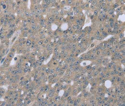 Anti-Human/Mouse BMX Antibody