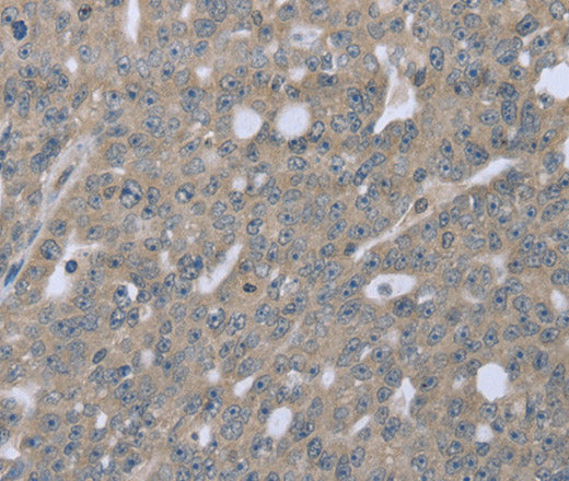 Anti-Human/Mouse BMX Antibody - ABMIUM