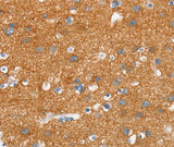 Anti-Human/Mouse/Rat SNCA Antibody - ABMIUM