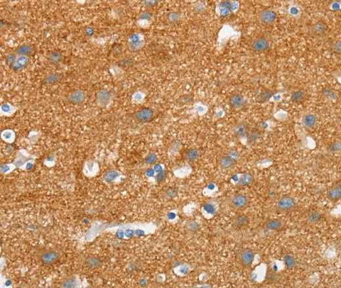 Anti-Human/Mouse/Rat SNCA Antibody