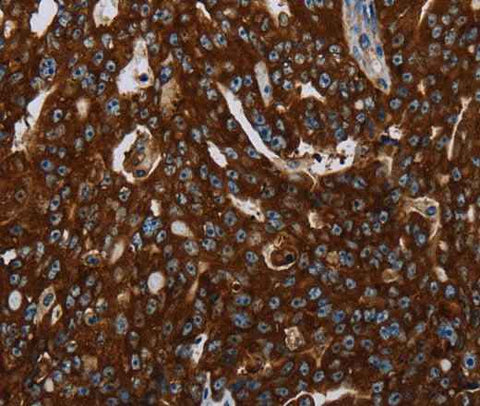 Anti-Human KISS1R Antibody