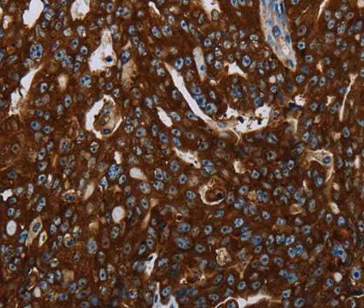 Anti-Human KISS1R Antibody