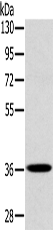 Anti-Human/Mouse/Rat CLP36 Antibody - ABMIUM