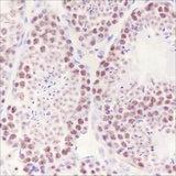 Anti-Human/Mouse HMGA1 Antibody [A442]