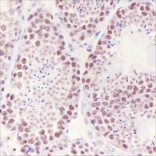 Anti-Human/Mouse HMGA1 Antibody [A442]