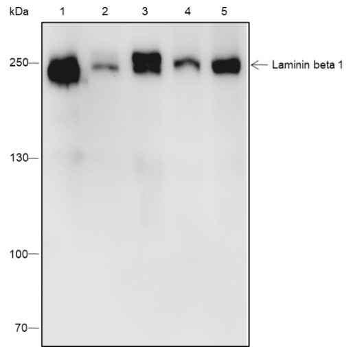Anti-Human/Rat/Mouse Laminin beta 1 Antibody [A545]