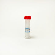 Bempedoic acid, ATP citrate lyase inhibitor