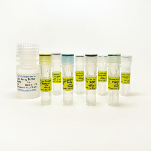 Glutamic Oxaloacetic Transaminase (GOT)/ Aspartate aminotransferase (AST) Activity Colorimetric Assay Kit