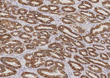 Anti-Human CA9 Antibody [A942] - ABMIUM