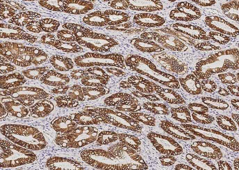 Anti-Human CA9 Antibody [A942] - ABMIUM