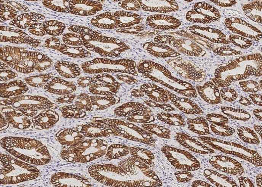 Anti-Human CA9 Antibody [A942] - ABMIUM