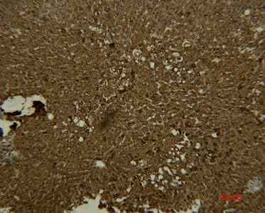 Anti-Human Transferrin Antibody [7H11]