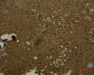 Immunohistochemistry of paraffin-embedded Human liver tissue using Transferrin Monoclonal Antibody at dilution of 1:50.