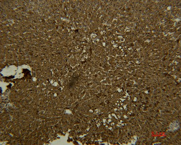 Immunohistochemistry of paraffin-embedded Human liver tissue using Transferrin Monoclonal Antibody at dilution of 1:50.