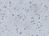 Immunohistochemistry of paraffin-embedded Human brain tissue using EFNB1 Polyclonal Antibody at dilution of 1:50(×200)